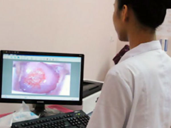 Có phải kiêng chuyện ấy khi bị viêm lộ tuyến cổ tử cung?
