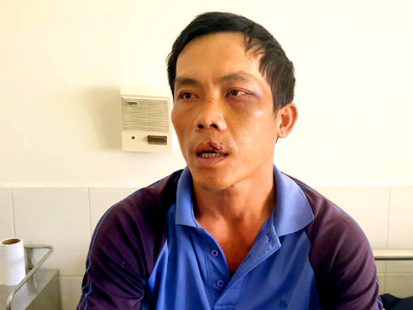 Nạn nhân bị trói và phơi nắng trên xe bán tải nhập viện cấp cứu