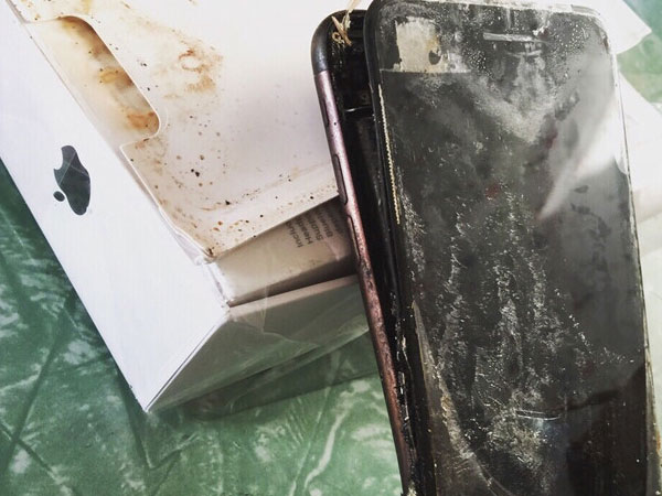 Nổ điện thoại iPhone lúc sạc, thiếu niên 13 tuổi phải cắt cụt bàn tay
