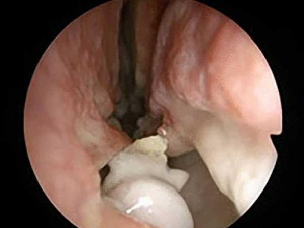 Những ca bệnh hi hữu tưởng chừng chỉ có trong phim viễn tưởng nhưng lại 'lộ diện' khiến mọi người bàng hoàng