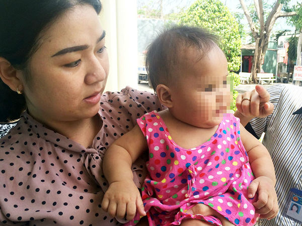 Bé gái 8 tháng tuổi nghi bị mẹ nuôi bạo hành, nhốt trong phòng trọ