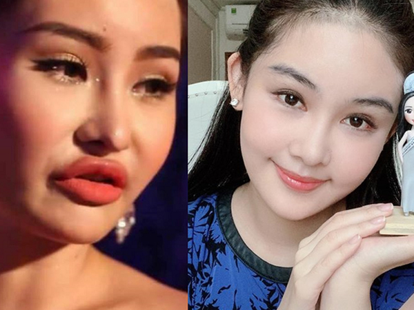 Ngân Anh so với thời mới đăng quang: Nhan sắc ngày càng khác lạ, môi không còn sưng phồng