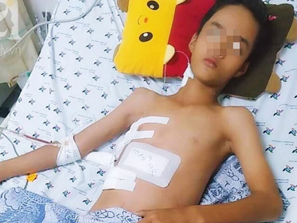 Tai nạn đau lòng: Đi làm mướn nuôi cha tâm thần, bé trai 13 tuổi bị thanh sắt máy cắt lúa đâm xuyên thấu ngực