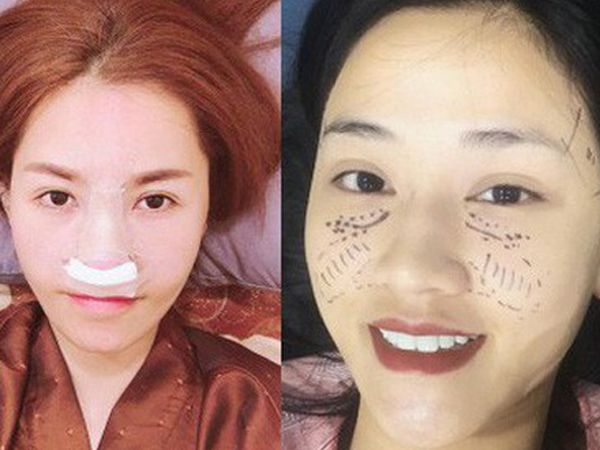 Chuyện 'dao kéo' của sao Vbiz: Người 20 ca đại phẫu mà cơ thể đang xuống cấp, kẻ U40 vẫn quyết cải thiện vẻ ngoài