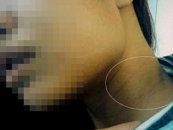 Lật lại vụ du học sinh Mỹ tố bị anh rể hờ là đại gia hiếp dâm