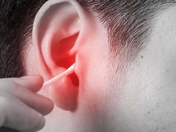 Lên cơn co giật vì ngoáy tai bằng tăm bông