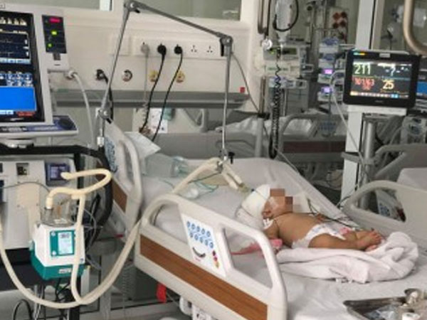 Bé gái gần 3 tháng tuổi bị chấn thương sọ não vì điện thoại rơi trúng đầu
