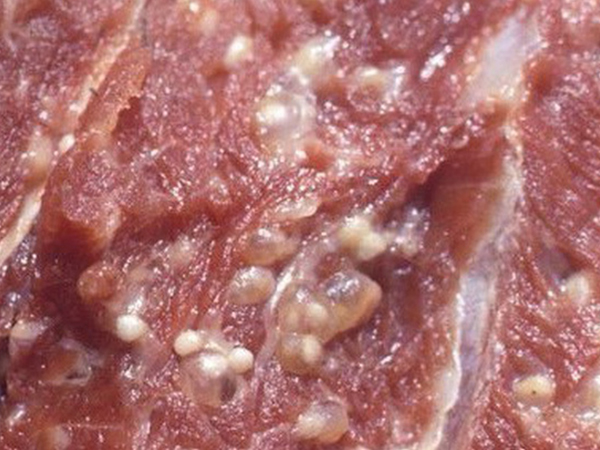 Bệnh sán lợn khiến 400 trẻ mầm non Bắc Ninh hốt hoảng đi xét nghiệm nguy hiểm thế nào?