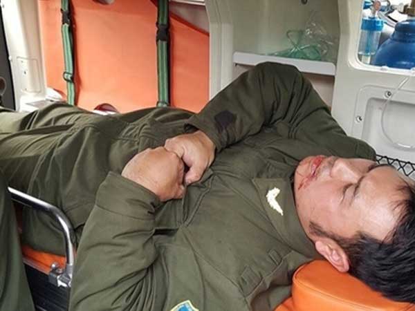 Đánh gãy răng nhân viên sân bay Nội Bài: Đối tượng thứ 2 lộ diện