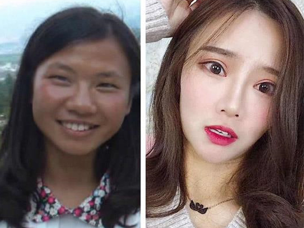 Thế hệ 10X Trung Quốc đổ xô đi dao kéo: Cuộc 'đầu tư' vào tương lai?