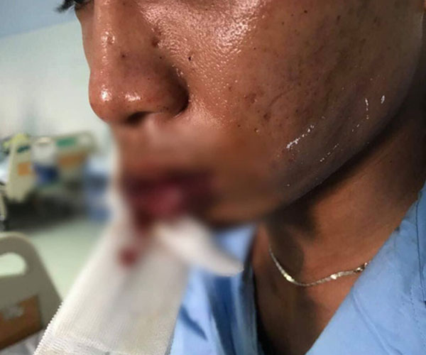 Băng giang hồ đòi bảo kê quán cà phê ở Bình Chánh sa lưới