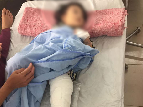 Hà Nội: Chó pitbull giật đứt xích lao vào cắn bé 2 tuổi, hàng xóm phải mang xà beng đánh chết con vật để giải cứu nạn nhân
