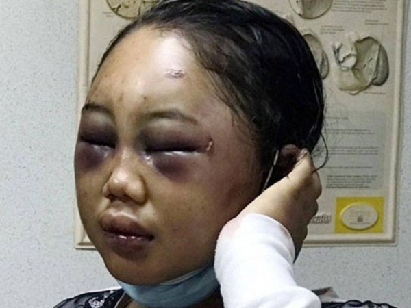 Tra tấn người giúp việc tàn bạo, ép ngủ với chó
