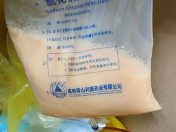 Túi mỡ 300ml lấy ra từ máu người đàn ông 47 tuổi chỉ vì hay ăn thực phẩm này