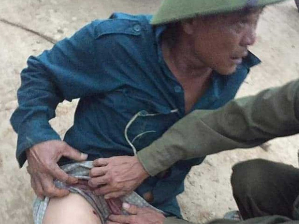 Tạm giữ nghi phạm bắn 3 viên đạn vào người đàn ông đi rừng về