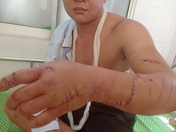 Bị chém trọng thương vì tranh cãi trong lúc đánh bài