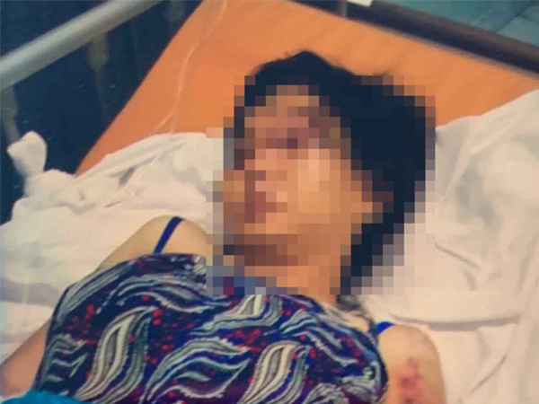 Vụ bà bầu bị tra tấn sinh non, thai nhi tử vong: Rùng rợn màn tra tấn bằng keo nấu chảy