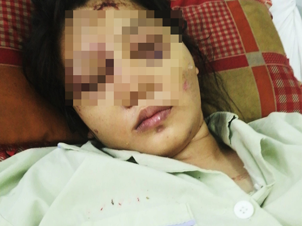 Cô gái mang bầu 6 tháng bị bắt cóc, tra tấn đến sảy thai bị sang chấn tâm lý, la hét, kích động trong bệnh viện