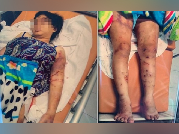 Vụ thai phụ 6 tháng bị 'bắt cóc', tra tấn dã man suốt 20 ngày đến sẩy thai: 2 kẻ chủ mưu đã bỏ trốn