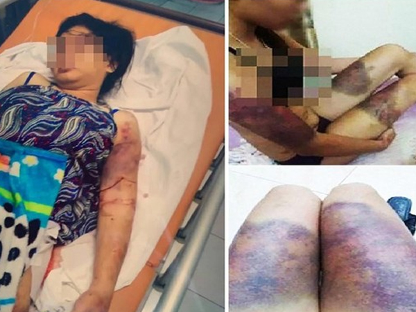 Rùng rợn lời kể của thai phụ bị 'bắt cóc', tra tấn suốt 20 ngày đến sẩy thai: 'Lúc con không còn đạp nữa, tôi năn nỉ thả về nhưng không được'