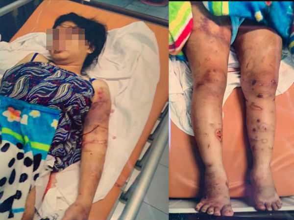 Vụ tra tấn như thời trung cổ khiến bà bầu sảy thai: Nạn nhân bị bắt hít ma tuý, dùng ná bắn vào vùng kín
