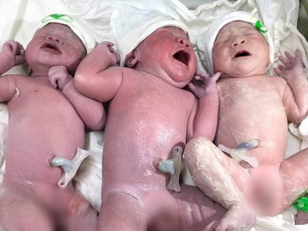 Hội bỉm sữa xôn xao trước ca sinh 3 'siêu tiết kiệm', đẻ một lần có đủ cả nếp lẫn tẻ