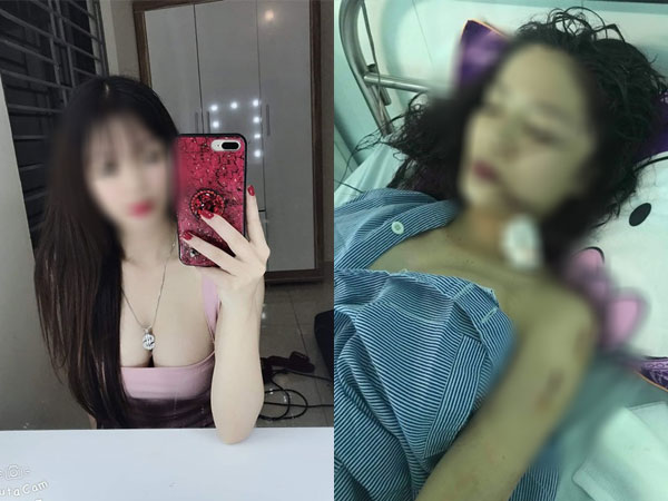 Chị ruột cô gái bị tấn công phải khâu 60 mũi: 'Mặt em tôi bị rạch như thế thì coi như hết đời người rồi'