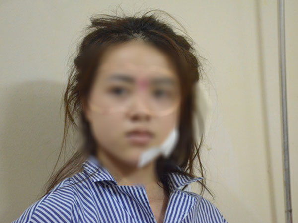 Cô gái rạch mặt khiến bạn cũ phải khâu 60 mũi trần tình: 'Q. đánh tôi trước, sao mọi người chỉ bênh cô ấy mà mạt sát tôi?'