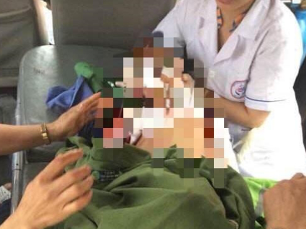 Lại một cháu bé bị chó nhà nuôi cắn dập nát cơ thể