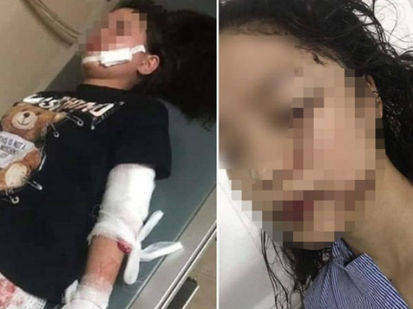 Những chi tiết rợn người qua lời kể của 2 cô gái tham gia vụ rạch mặt thiếu nữ xinh đẹp