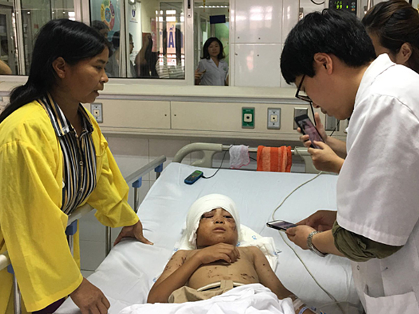 Bé trai bị chó cắn mất 2 tai đang được theo dõi chấn thương sọ não