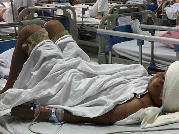 Máu trộn bùn ruộng khắp người em bé Thanh Hoá bị 2 con chó becgie cắn