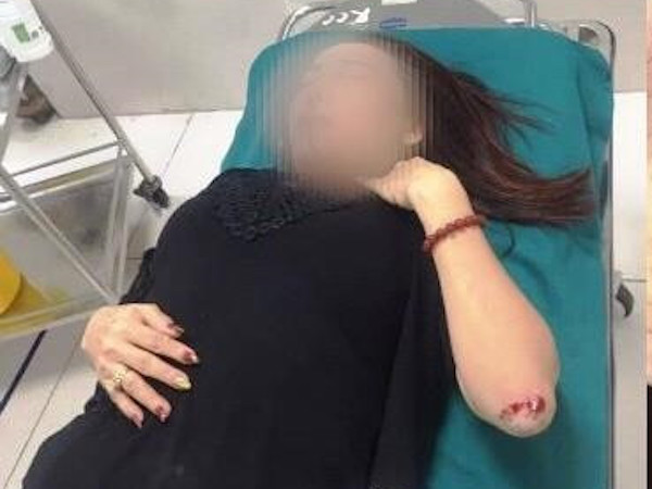 Tìm thấy 4 viên đạn ở nhà nữ doanh nhân tố bị 'xã hội đen' truy sát