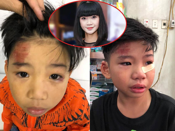 Hai con nhỏ của siêu mẫu Hạ Vy bị 'xe điên' tông chấn thương não rồi bỏ chạy