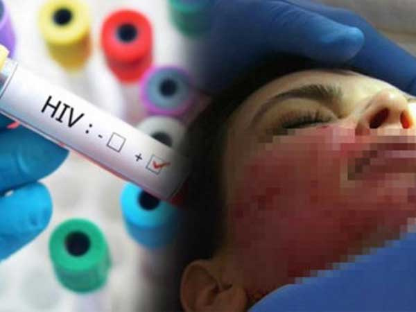 Sững người trước kết quả dương tính với HIV sau thẩm mỹ, đã có 1 trường hợp tại Việt Nam