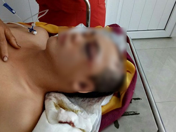 Truy lùng hung thủ chém người, cướp tài sản giữa ban ngày
