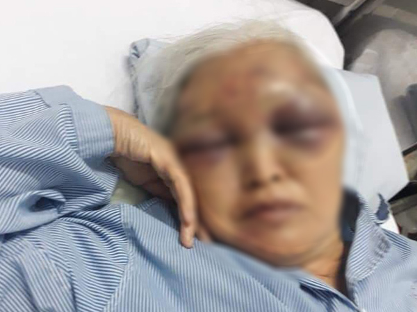Hà Nội: Đến thăm con vào giữa đêm không được đồng ý, rể cũ ra tay đánh mẹ vợ nhập viện