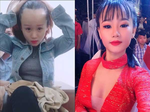 Nỗi khổ của con gái trán dô: Mũi tẹt, mắt híp, răng hô còn thẩm mỹ được còn trán sân bay thì biết sửa đường nào đây?
