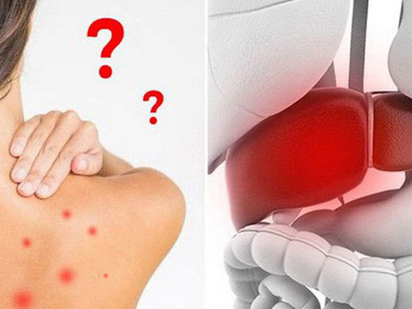 Khi bạn uống nước rồi những vẫn cảm thấy khát: Hãy cảnh giác với 5 căn bệnh nguy hiểm