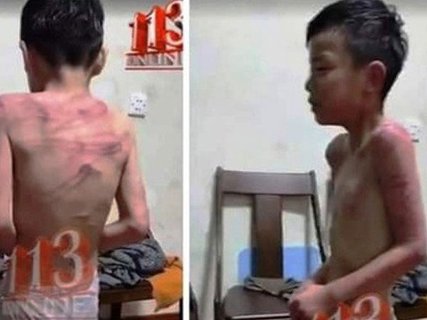 Thông tin bé trai bị bố dượng đánh đập ở Thanh Hóa là thất thiệt