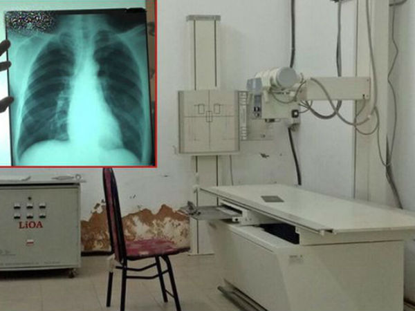 Bé gái nghi bị hiếp dâm trong phòng X-quang: Chụp chiếu tim, phổi nhưng bắt cởi cả quần lót...