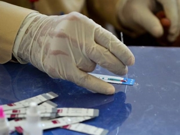 Hơn 500 trẻ em nhiễm HIV tại thành phố Pakistan