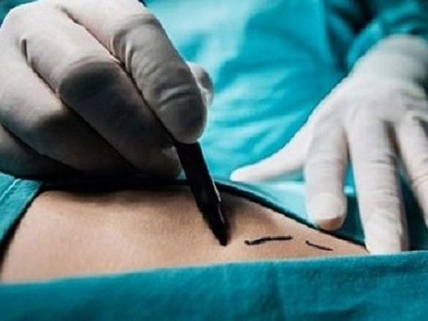 Nhóm người mua bán thận giá hàng trăm triệu đồng ở Hà Nội