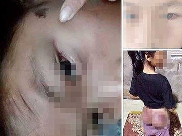 Công an viên đánh bé gái 12 tuổi tím người vì nghi trộm 50.000 đồng