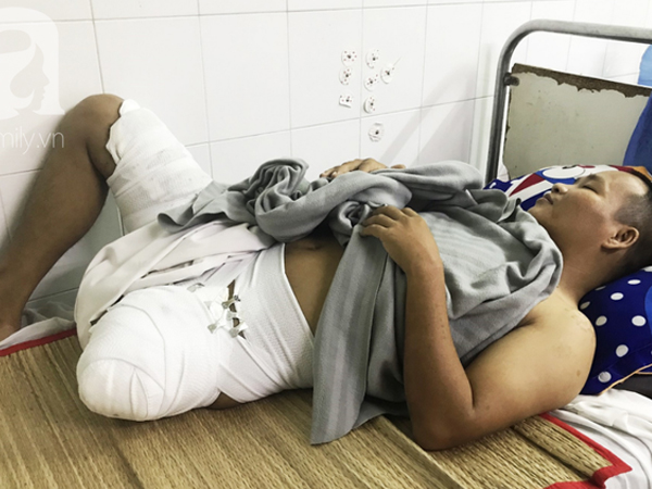 Đi làm thuê để lo cho vợ sắp sinh, chồng bị tai nạn nguy kịch phải cắt bỏ 1 chân