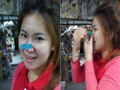 Thiếu nữ liều lĩnh tự dùng kẹp quần áo làm gọn mũi