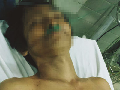 Truy tìm người phụ nữ chém nhân tình gục xuống bên đường