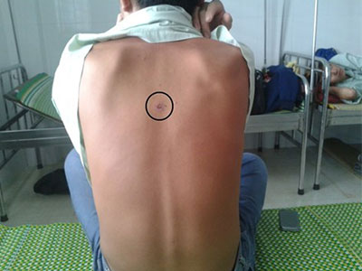Trưởng công an xã bị tố bắn, đánh dân nhập viện