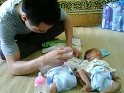 Người chồng trẻ loay hoay với vợ trầm cảm, con sinh đôi suy dinh dưỡng nặng