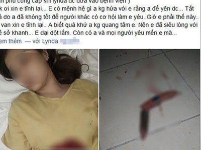 Ảnh bìa bài viết 281267